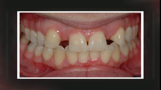 Orthodontist Littleton Oct2013