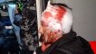 Kiev : des journalistes agressés par des policiers