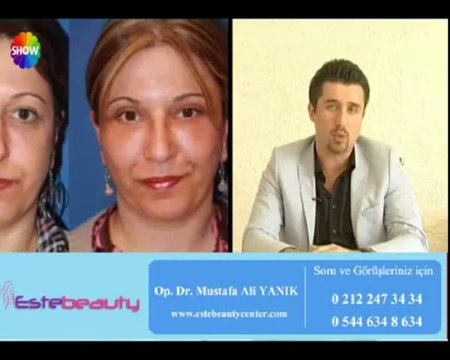 Op Dr Mustafa Ali Yanık Alın Germe Dolgu ve Botoks Uygulamaları hakkında bilgi veriyor