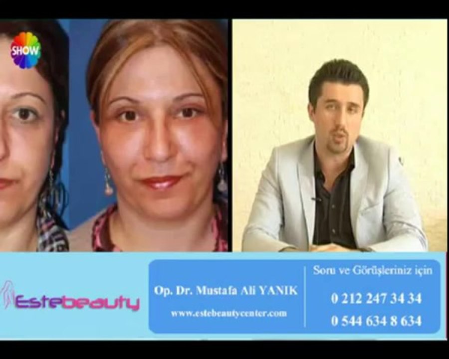 Op Dr Mustafa Ali Yanık Alın Germe Dolgu ve Botoks Uygulamaları hakkında bilgi veriyor