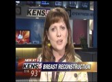 Breast Reconstruction | PRMA Becomes Hub for Innovative Reconstructive Surgery After Mastectomy
