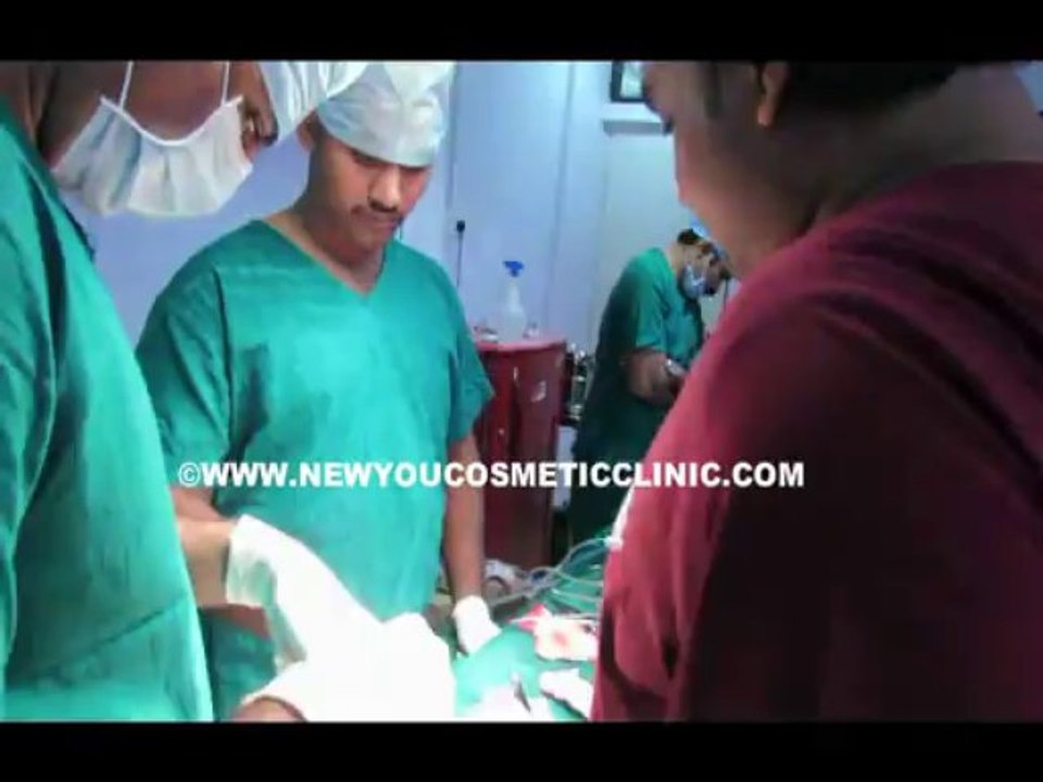 Nose Reshaping Done in India