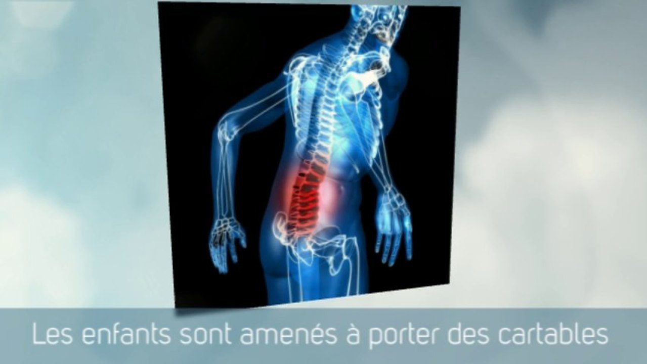 Mal de dos et comment cesser en 7 jours ✔ Le mieux noté - FR