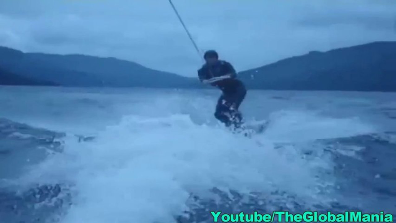 WakeBoarding Accident
