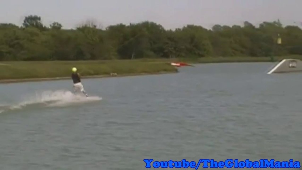 Water Sports Accident; Wakeboarding Faceplant
