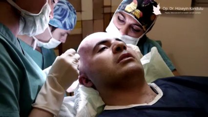 Saç Ekimi İşlemi - Op. Dr. Hüseyin Kandulu