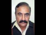 Best  Hair Transplant in pakistan, hair transplant surgery,Gujrat Pakistan,www.fuepakistan.com