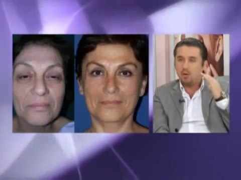 Op Dr Mustafa Ali Yanık Ameliyatsız Estetik Uygulamaları İle İlgili Bilgi Veriyor