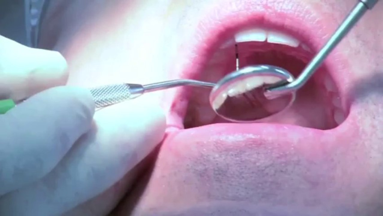 Best Dentist In Shoreview, MN -- What to expect on your first visit to the dentist?