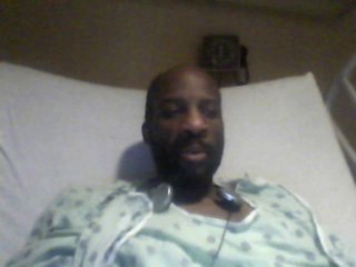 I survived colon cancer surgery