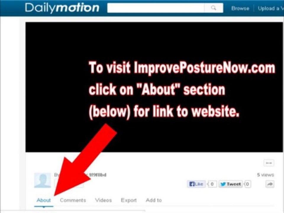 FL ORTHOS BRACE REVIEWS | Dont Buy A Florida Orthopedics Posture Brace Until You See This!