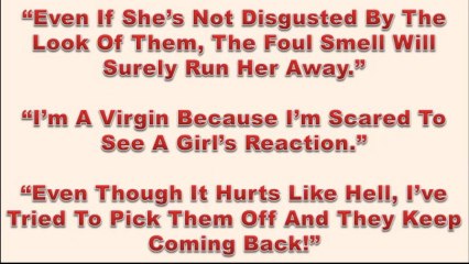 Pearly Penile Papules Foreskin