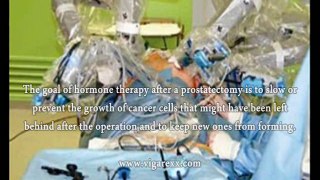 Prostatectomy Hormone Therapy, Does Prostatectomy Hormone Therapy Work