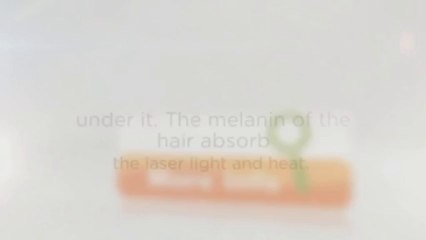 Laser hair removal for dummies_(480p)