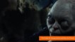 Gollum and Other Evildoers in 'The Hobbit' Suffer from 'Vitamin D Deficiency'