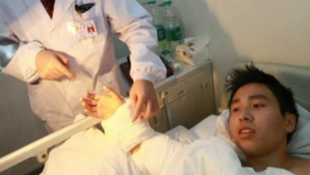 Man's severed hand grafted to foot after accident