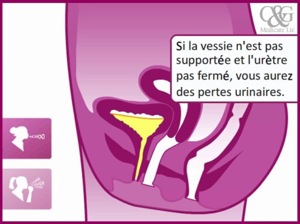 Incostress : l'allié de votre périnée