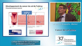 Cancer du col utérin