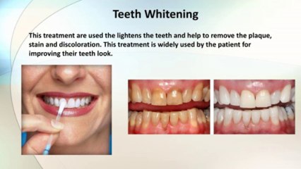 Dr khosla's - Dental Clinic in Gurgaon