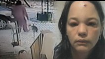 Woman Attacked By Cat Tells Her Story