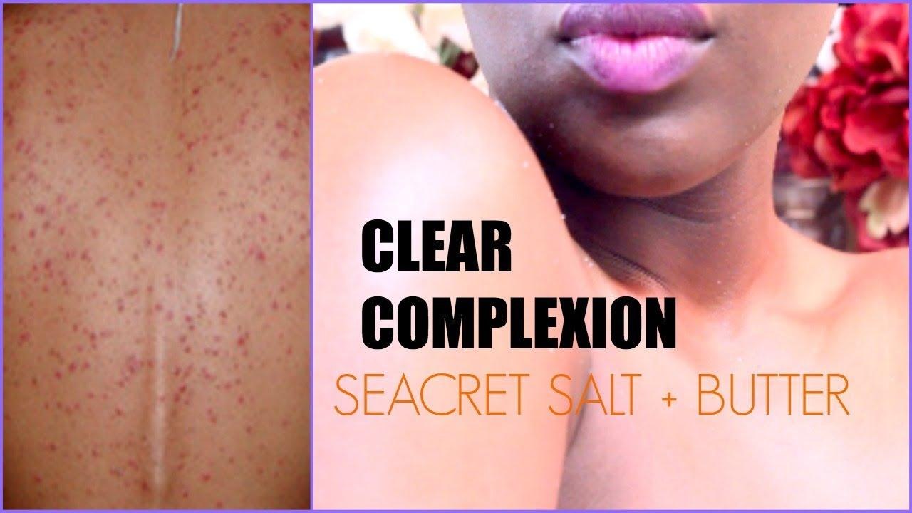CLEAR COMPLEXION | ACNE on your back + Lighten Knuckles and Elbows + Deep Body Exfoliation