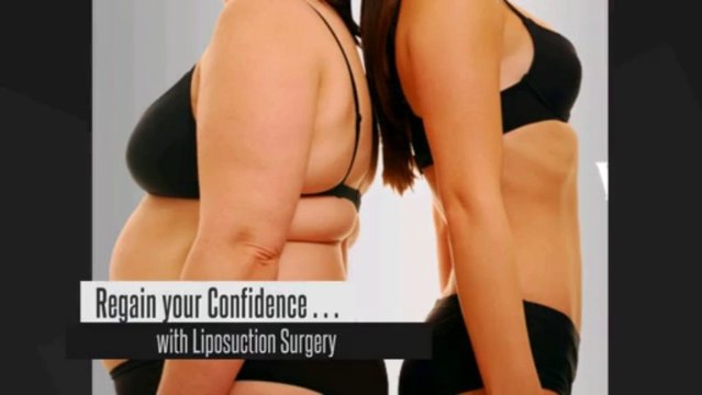 Liposuction Surgery - The Lipo Clinic & Spa