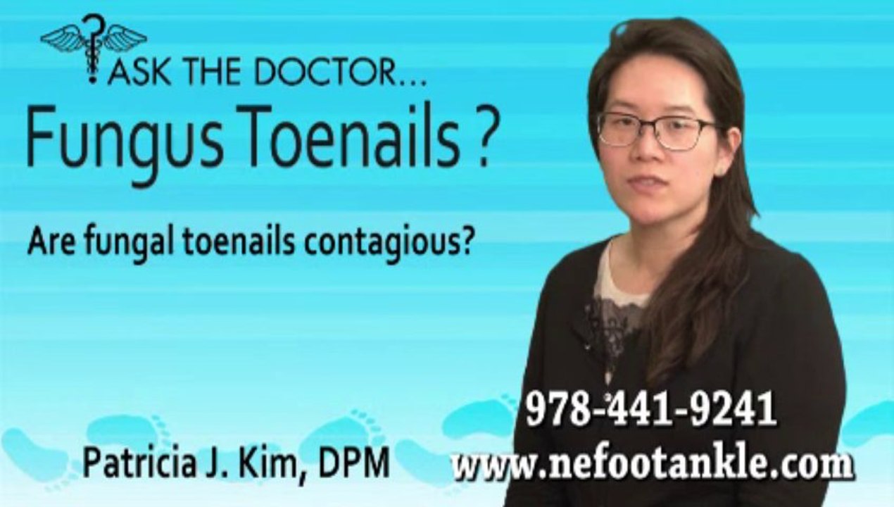 Fungal Toenails Contagious? Podiatrist in Newburyport, Chelmsford, Lawrence, MA