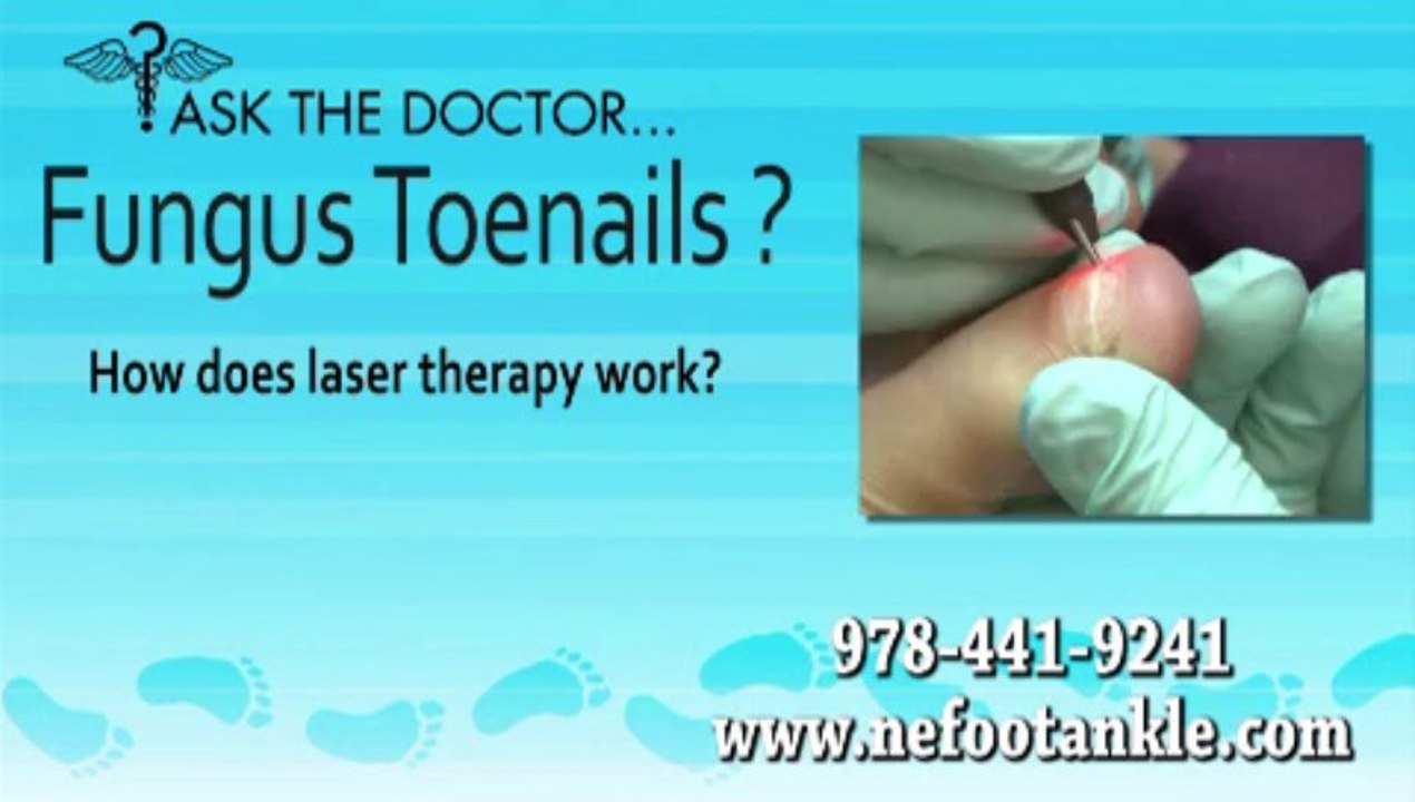 How Does Laser Therapy Work?  Podiatrist - Newburyport,  Chelmsford, Lawrence, MA