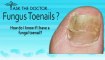 Do I Have Fungal Toenails? Podiatrist in  Newburyport, Chelmsford,Lawrence, MA