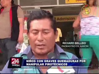 VMT: niños heridos tras manipular material pirotécnico necesitan urgente ayuda