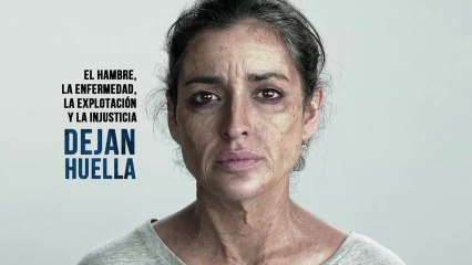 Descubre cómo se vería tu rostro si vivieras en extrema pobreza