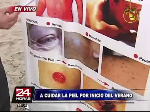 Círculo Dermatológico del Perú brinda recomendaciones para cuidar la piel