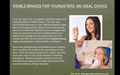 Invisible Braces - The Best Option to Correct Teeth Alignment