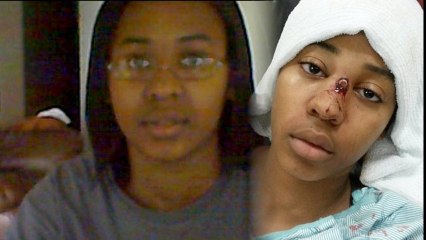 16 Year Old Survives Shot to the Face Thanks to Her Glasses