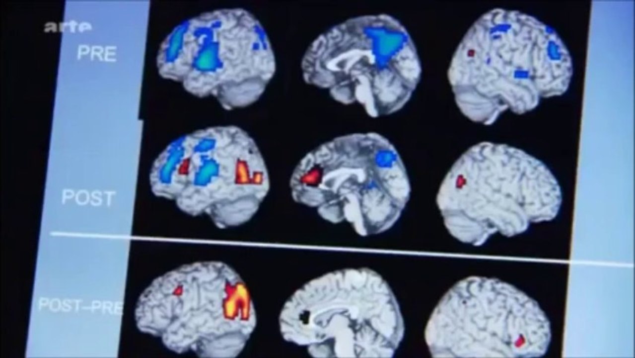 Qu’est-ce que la  plasticité du cerveau ?