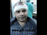FUE hair transplant surgery,Gujrat Pakistan,www.fuepakistan.com