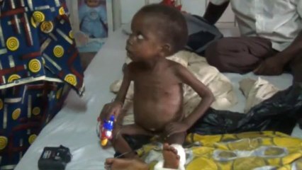 Les enfants victimes des violences en Centrafrique