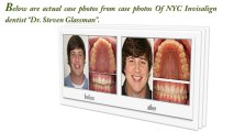 Invisalign || Invisalign NYC || Invisalign Dentist || Top Invisalign Dentist NYC || Invisalign Cost