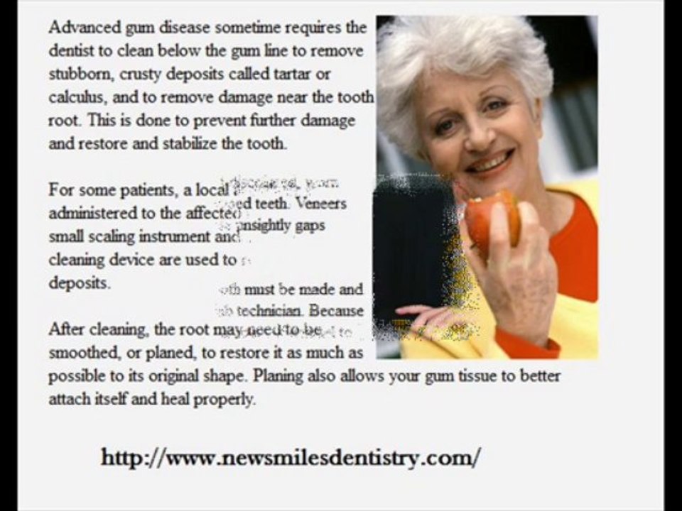 Crown treatment by dentist in Manhattan Beach