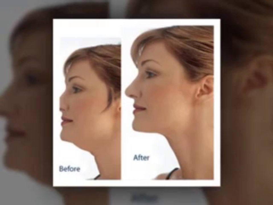 How to lose fat face - Get rid of Chubby Cheeks and Double Chin