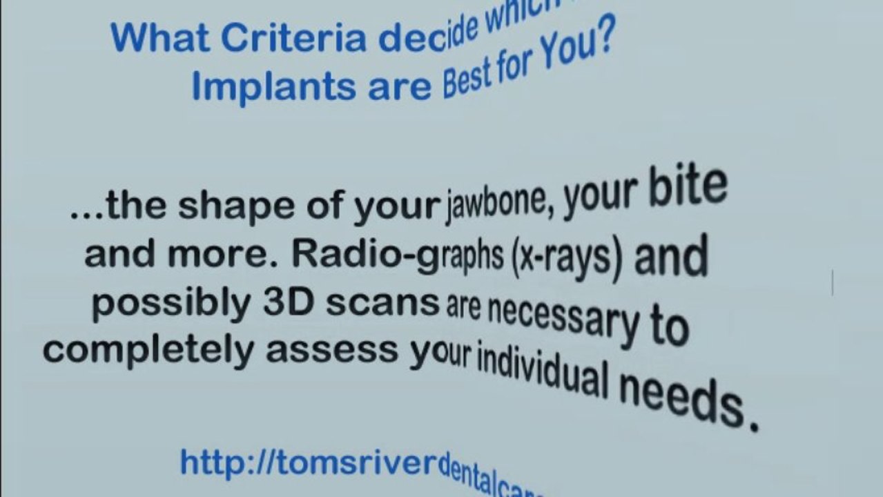 Not all Dental Implants are Created Equal