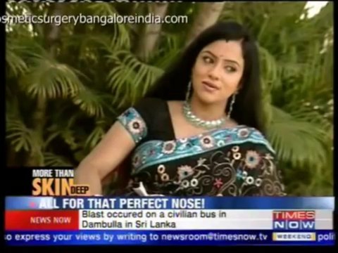 Nose Reshaping (Rhinoplasty) at Bangalore India