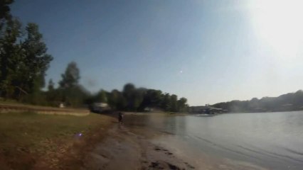 Dirt Bike Crash through Lake (Leg Infection)
