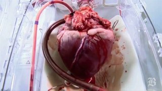 Beating heart aftr removal frm body- SUBHAN ALLAH