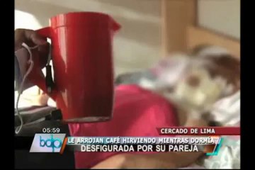 Carabayllo: Mujer fue estrangulada por rechazar volver con su pareja (2/2)