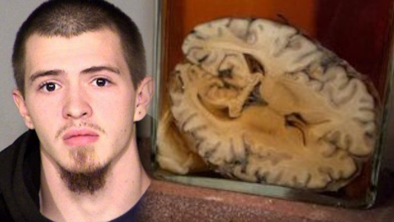 Man Steals Vintage Brains, Sells Them on eBay