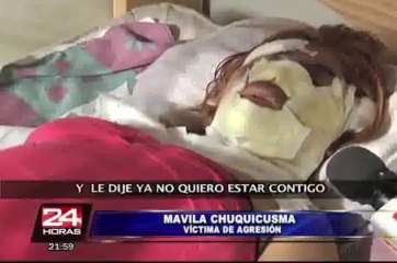 Sujeto que desfiguró a su pareja con agua hirviendo quedó detenido en la Fiscalía