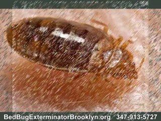 Bed Bugs Rash - See If You Have It