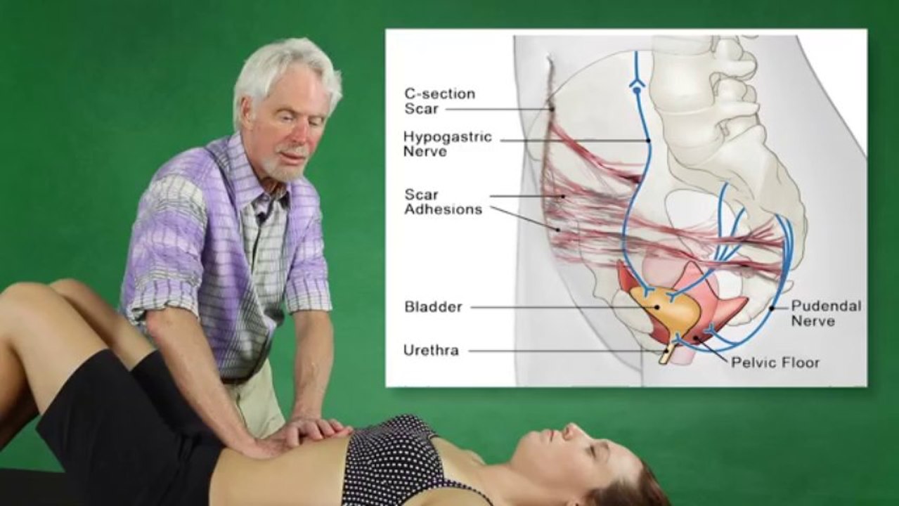 Scar Remodeling Adhesions & Nerve Pain - Erik Dalton