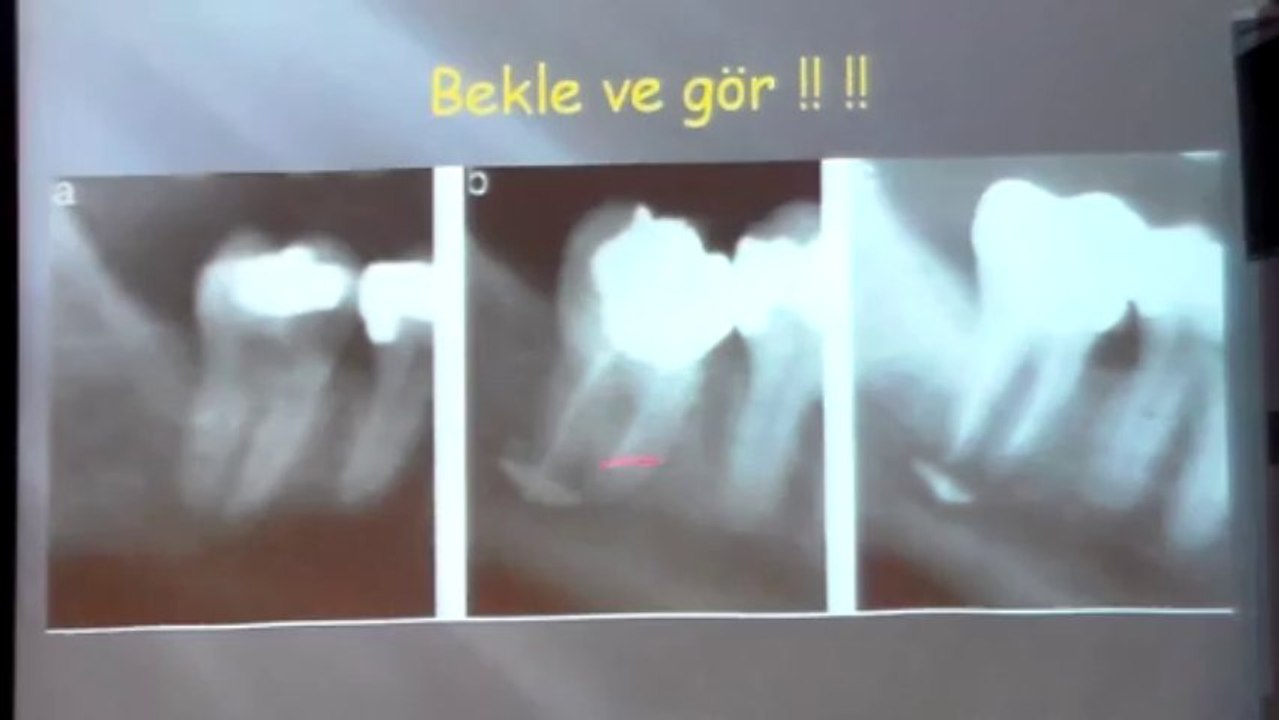 DOÇ.DR.ÖZGÜR TOPUZ 19 ARALIK 2013 ADO EĞİTİM SEMİNERİ 4